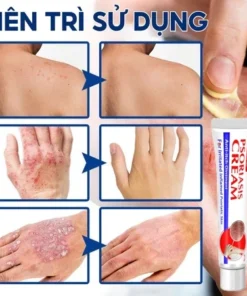 kem bôi nấm ngứa nhật bản bôi nấm ngứa vùng kín nam chống dị ứng khỏi tận gốc viêm da bệnh chàm Ngứa da nấm da nấm mụn n 13 nguanhat3