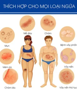 kem bôi nấm ngứa nhật bản bôi nấm ngứa vùng kín nam chống dị ứng khỏi tận gốc viêm da bệnh chàm Ngứa da nấm da nấm mụn n 18 nguanhat8