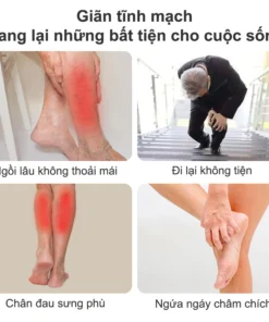 Kem Giãn Tĩnh Mạch Nga Cải Thiện Lưu Thông Máu Giữ Lại Vẻ Đẹp Cho Đôi Chân 17 ogian3
