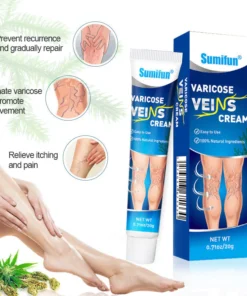 Sumifun Kem Suy Giãn Tĩnh Mạch Giúp Giảm Đau Mỏi, Mất Thẩm Mỹ Do Suy Giãn Tĩnh Mạch Gây Ra