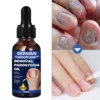 Tinh Chất German Removal Paronychia Oil Phục Hồi Móng - Bảo Vệ Móng Khỏi Nấm Móng - Kháng Khuẩn