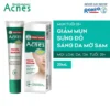 Tinh Chất Chuyên Biệt Cho Da Mụn 25+ Facial Serum Acnes 20ml