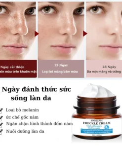 Alternative view of Kem nám tàn nhang ,Kem xóa nám FRECKLE CREAM mờ nám tàn nhang đồi mồi dưỡng ẩm da phục hồi da chống lão hoá