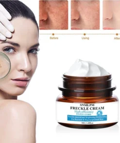 Kem nám tàn nhang ,Kem xóa nám FRECKLE CREAM mờ nám tàn nhang đồi mồi dưỡng ẩm da phục hồi da chống lão hoá 12 fres7