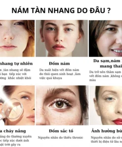 Kem nám tàn nhang ,Kem xóa nám FRECKLE CREAM mờ nám tàn nhang đồi mồi dưỡng ẩm da phục hồi da chống lão hoá 15 frew4