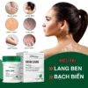 Kem Lang Ben South Moon 35g Hỗ Trợ Dứt Điểm Lang Ben, Bạch Biến, Chàm Da Hiệu Quả