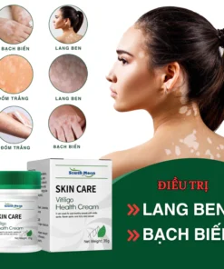 Kem Lang Ben South Moon 35g Hỗ Trợ Dứt Điểm Lang Ben, Bạch Biến, Chàm Da Hiệu Quả