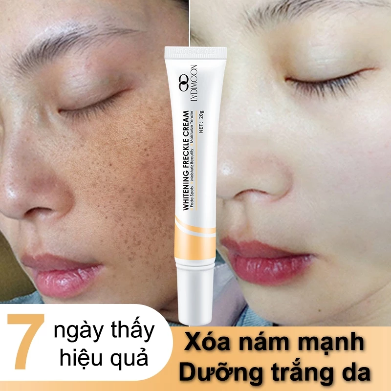 Kem nám tàn nhang và loại bỏ đốm kem dưỡng trắng da mặt 20g làm sáng trắng da chống lão hóa nhanh chóng 1 Kem nám tàn nhang và loại bỏ đốm kem dưỡng trắng da mặt 20g làm sáng trắng da chống lão hóa nhanh chóng