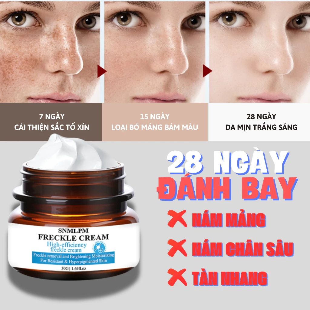 Kem nám tàn nhang ,Kem xóa nám FRECKLE CREAM mờ nám tàn nhang đồi mồi dưỡng ẩm da phục hồi da chống lão hoá 29 kemnam1