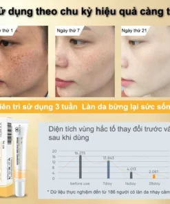 Kem nám tàn nhang và loại bỏ đốm kem dưỡng trắng da mặt 20g làm sáng trắng da chống lão hóa nhanh chóng 13 kemnam3