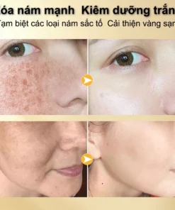 Kem nám tàn nhang và loại bỏ đốm kem dưỡng trắng da mặt 20g làm sáng trắng da chống lão hóa nhanh chóng 15 kemnam6