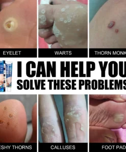 Alternative view of Kem South Moon bôi Rụng Mụn Thịt, Mụn Cóc, Nốt Ruồi, Dưỡng Da, Làm Trắng Da, thành phần thiên nhiên-Herbal Cream