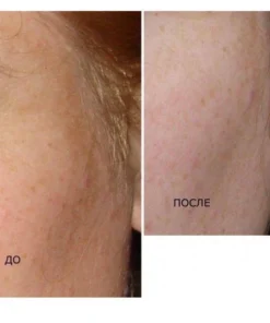 Alternative view of Kem nám tàn nhang Kpem Nga mờ nám tàn nhang dưỡng ẩm da phục hồi da chống lão hoá dưỡng da trắng