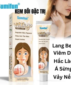 Alternative view of Kem bôi lang ben, kem kháng khuẩn loại bỏ bạch biến, hắc lào, á sừng Không kích ứng chăm sóc da 20g