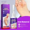 Serum bong chai sần, mụn cóc Wart Removal - Tinh chất Wart Removal tẩy mụn cóc, mụn cơm, chai sần không để lại sẹo 20ml