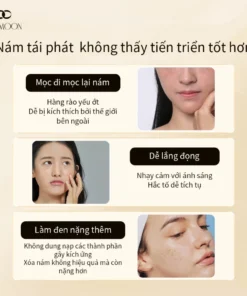Alternative view of Kem nám tàn nhang kem đặc chấm tàn nhang nám tàn nhang 20g Loại bỏ các đốm đen sâu làm sáng trắng da