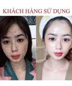 Serum giảm mụn thâm Seimy - Skin 7 Days Plus - 10ml 17 semi8