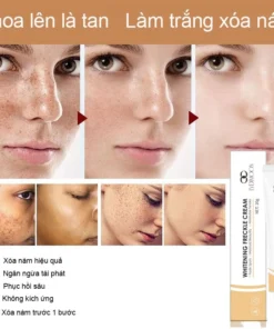 Kem xóa tàn nhang 20g loại bỏ nám loại bỏ đốm Loại bỏ các đốm đen sâu làm sáng trắng da chống lão hóa nhanh