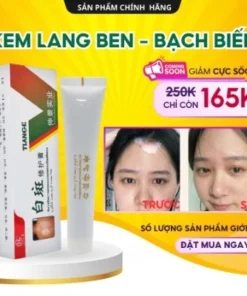 Kem Lang Ben TIANGE Hỗ Trợ Dứt Điểm Lang Ben, Bạch Biến, Chàm Da Hiệu Quả