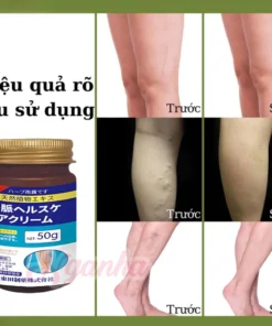Kem Giãn Tĩnh Mạch NHẬT BẢN,Cải Thiện Lưu Thông Máu Giữ Lại Vẻ Đẹp Cho Đôi Chân 13 tinhmach2