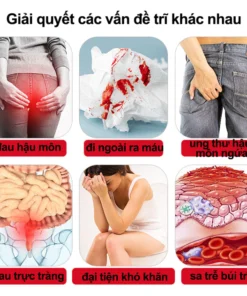 Alternative view of Kem bôi trĩ gel bôi trĩ Loại bỏ Trĩ hỗn hợp trĩ nội trĩ ngoại ngứa Đại tiện ra máu nứt hậu môn Giảm sưng 20g