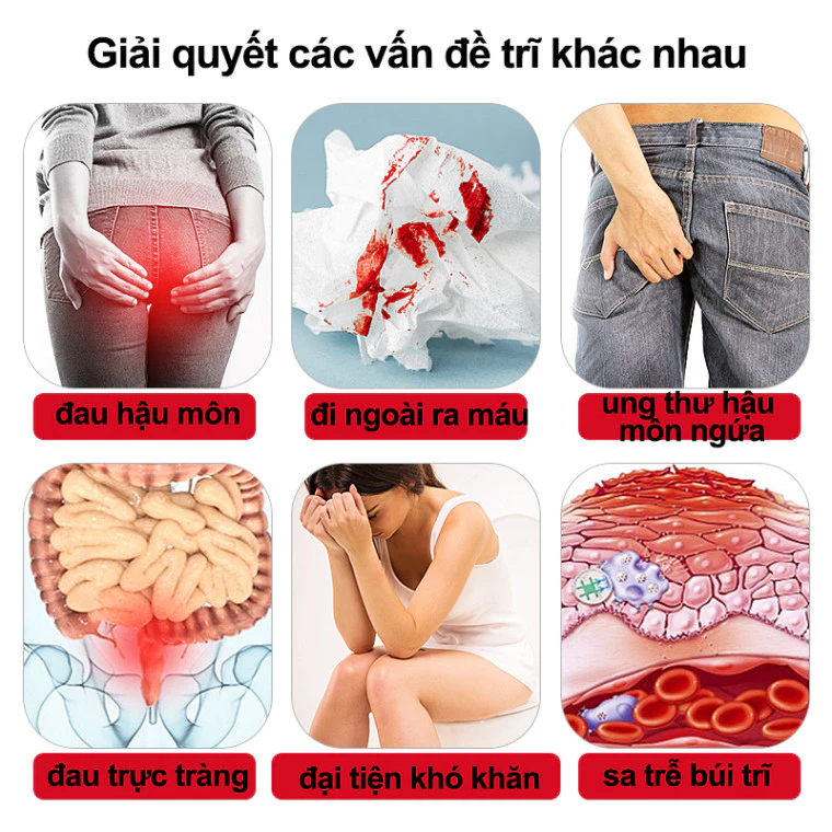 Kem bôi trĩ gel bôi trĩ Loại bỏ Trĩ hỗn hợp trĩ nội trĩ ngoại ngứa Đại tiện ra máu nứt hậu môn Giảm sưng 20g 25 boitr3