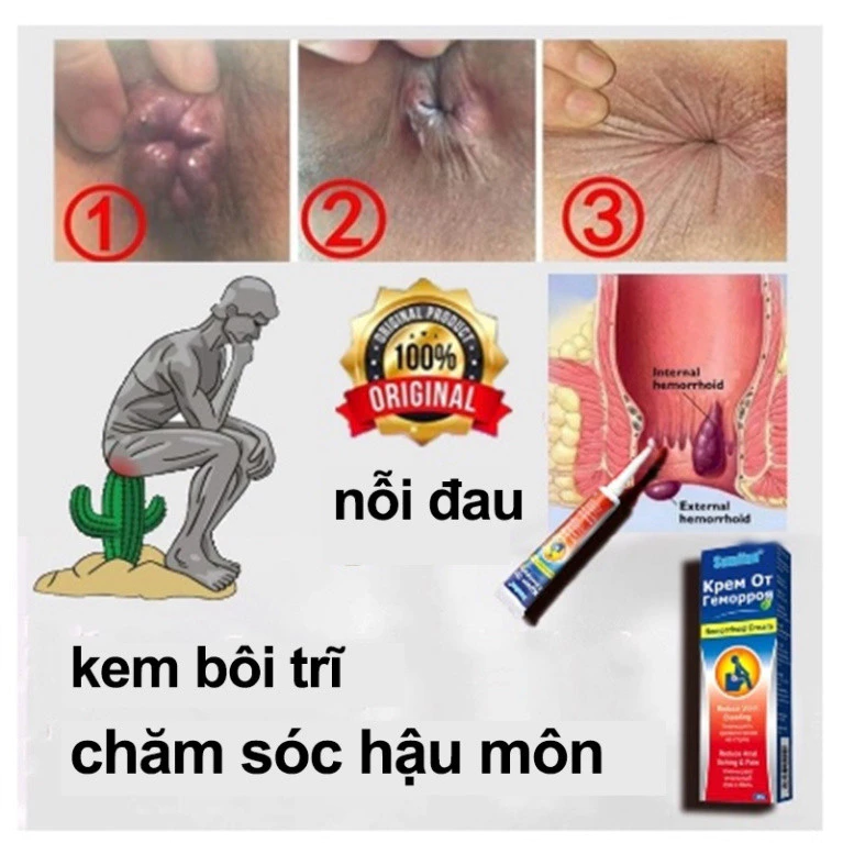 Kem bôi trĩ gel bôi trĩ Loại bỏ Trĩ hỗn hợp trĩ nội trĩ ngoại ngứa Đại tiện ra máu nứt hậu môn Giảm sưng 20g 22 boitri4