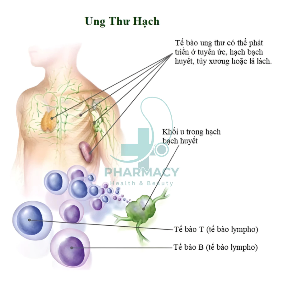 Kem Bôi Tan Hạch Bạch Huyết Cổ Truyền Nhật Bản , Tan Biến U Hạch, Giảm Đau Sưng Hạch Nhập Khẩu Chính Hãng 14 chiu3