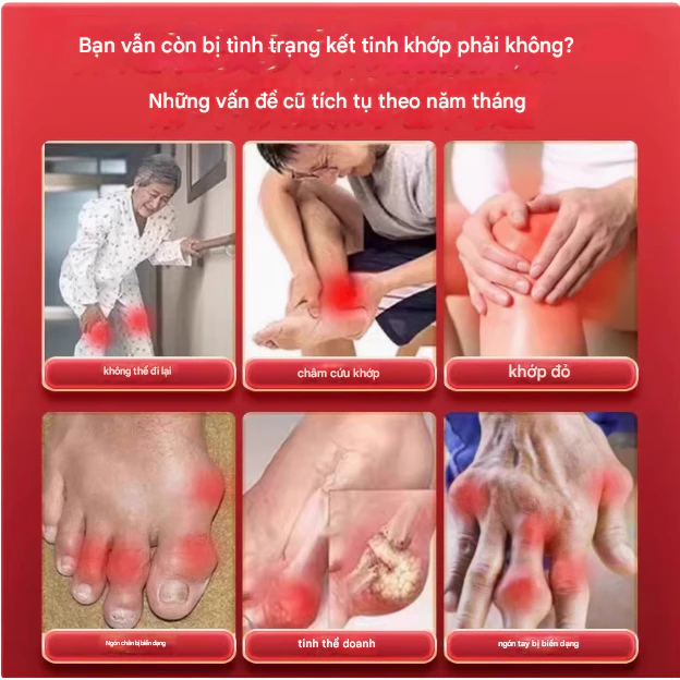 Kem Xoa Bóp Xương Khớp Dr. Mitsui Hỗ Trợ Làm Dịu Vùng Cơ Xương Khớp, Cảm Giác Dễ Chịu 18