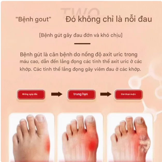 Kem Xoa Bóp Xương Khớp Dr. Mitsui Hỗ Trợ Làm Dịu Vùng Cơ Xương Khớp, Cảm Giác Dễ Chịu 17