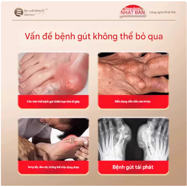 Kem Xoa Bóp Xương Khớp Dr. Mitsui Hỗ Trợ Làm Dịu Vùng Cơ Xương Khớp, Cảm Giác Dễ Chịu 16
