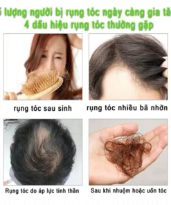 Dầu Gội Thảo Dược Hỗ Trợ Giảm Gãy Rụng, Kích Thích Mọc Tóc Chiết Xuất Củ Gừng 12 daugoi5
