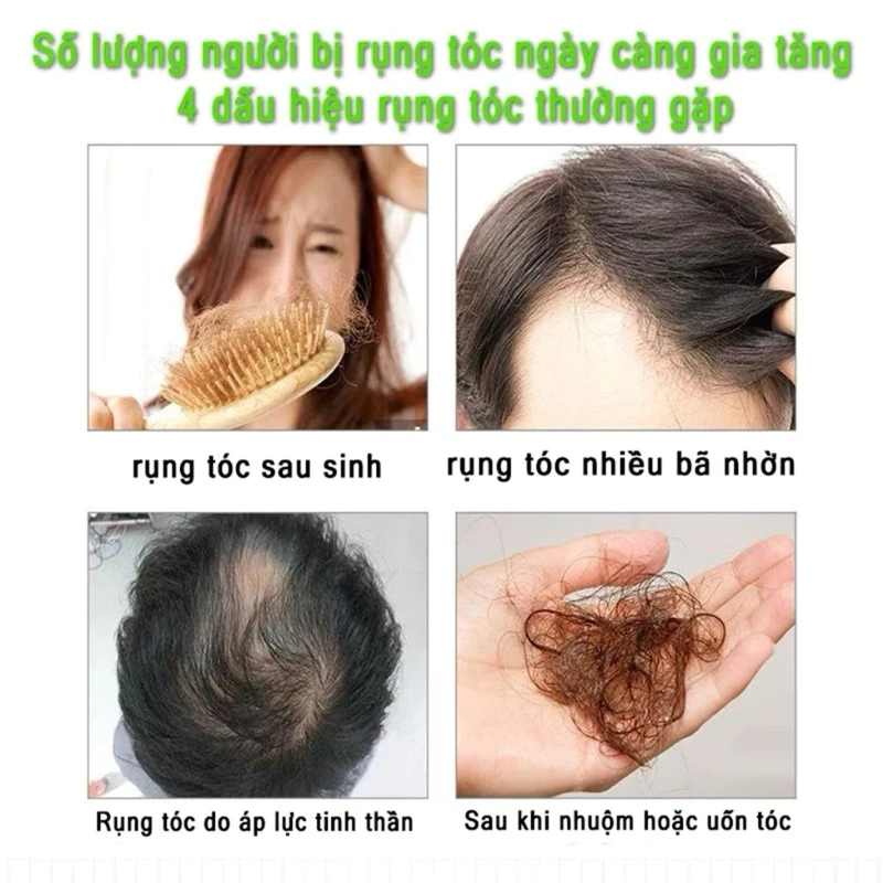 Dầu Gội Thảo Dược Hỗ Trợ Giảm Gãy Rụng, Kích Thích Mọc Tóc Chiết Xuất Củ Gừng 19 daugoi5