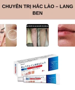 Alternative view of Kem Bôi Da Nhật Bản Chính Hãng – Dứt Điểm Nấm Ngứa, Hắc Lào, Nước Ăn Chân, Tổ Đỉa