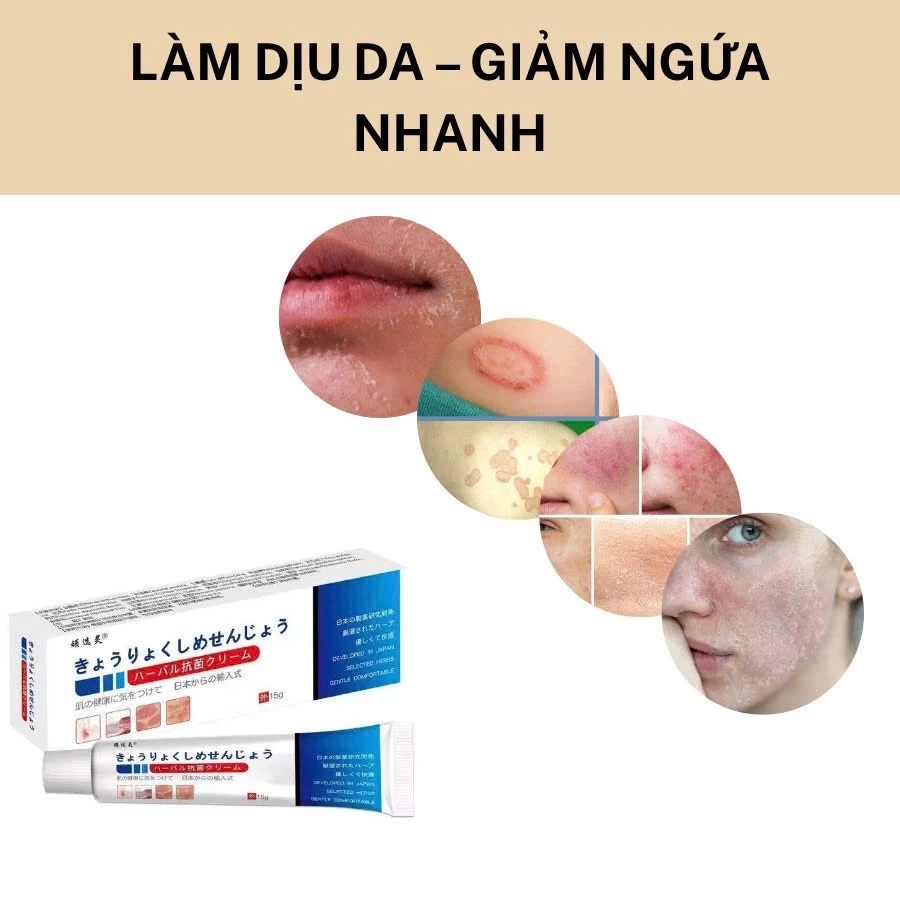 Kem Bôi Da Nhật Bản Chính Hãng – Dứt Điểm Nấm Ngứa, Hắc Lào, Nước Ăn Chân, Tổ Đỉa 20 kemnhat6