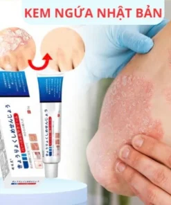 Kem Bôi Da Nhật Bản Chính Hãng – Dứt Điểm Nấm Ngứa, Hắc Lào, Nước Ăn Chân, Tổ Đỉa 17 kemnhat8