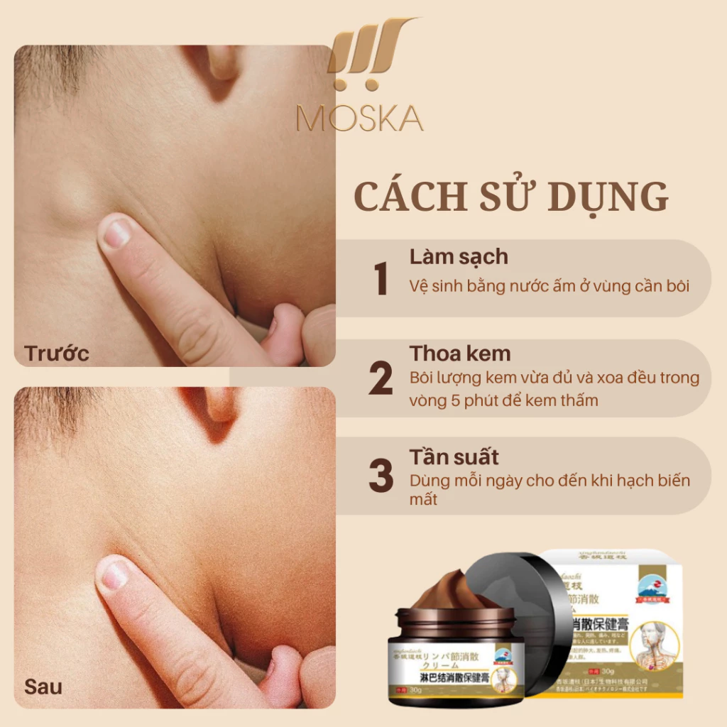 Kem Tan Hạch Cổ Truyền Nhật Bản, Teo U Hạch, Kem Mỡ Tiêu Tan Hạch Bạch Huyết 30g 19 kemtanhc5