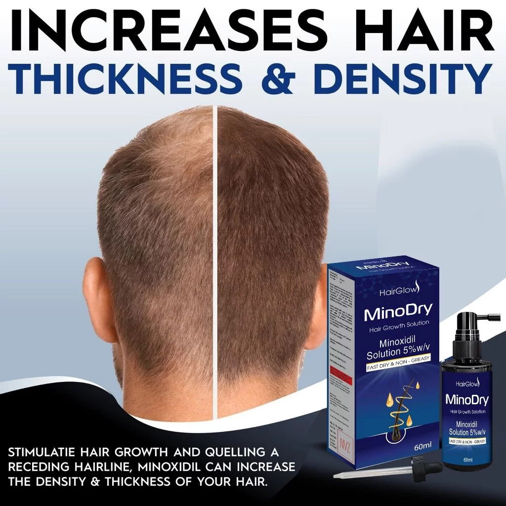 Serum kích mọc râu, tóc, mày MinoDry Minoxidil 5% besthair không kích ứng, không bết tóc, nhanh khô 24