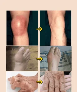 Kem Nọc Ong bôi xương khớp, giảm đau lưng mỏi vai gáy 19 nocng9