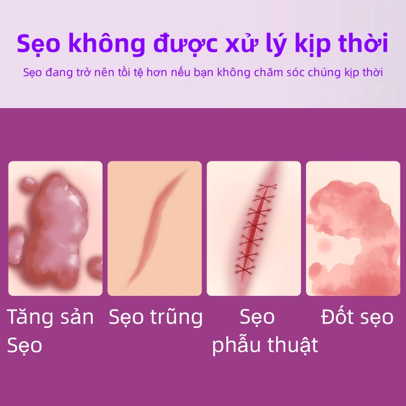 Kem LàM Mờ SẹO ThâM thâm sẹo do bị thương sẹo bỏng 20 seo3