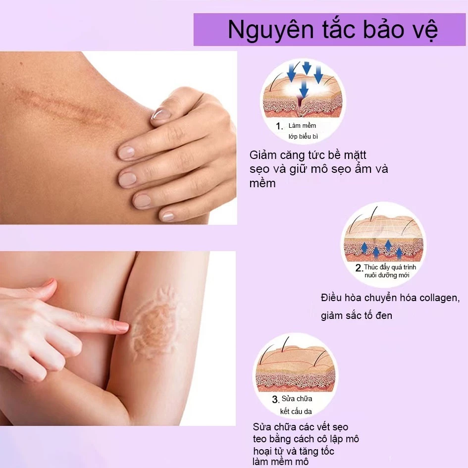 Kem LàM Mờ SẹO ThâM thâm sẹo do bị thương sẹo bỏng 18 seo5