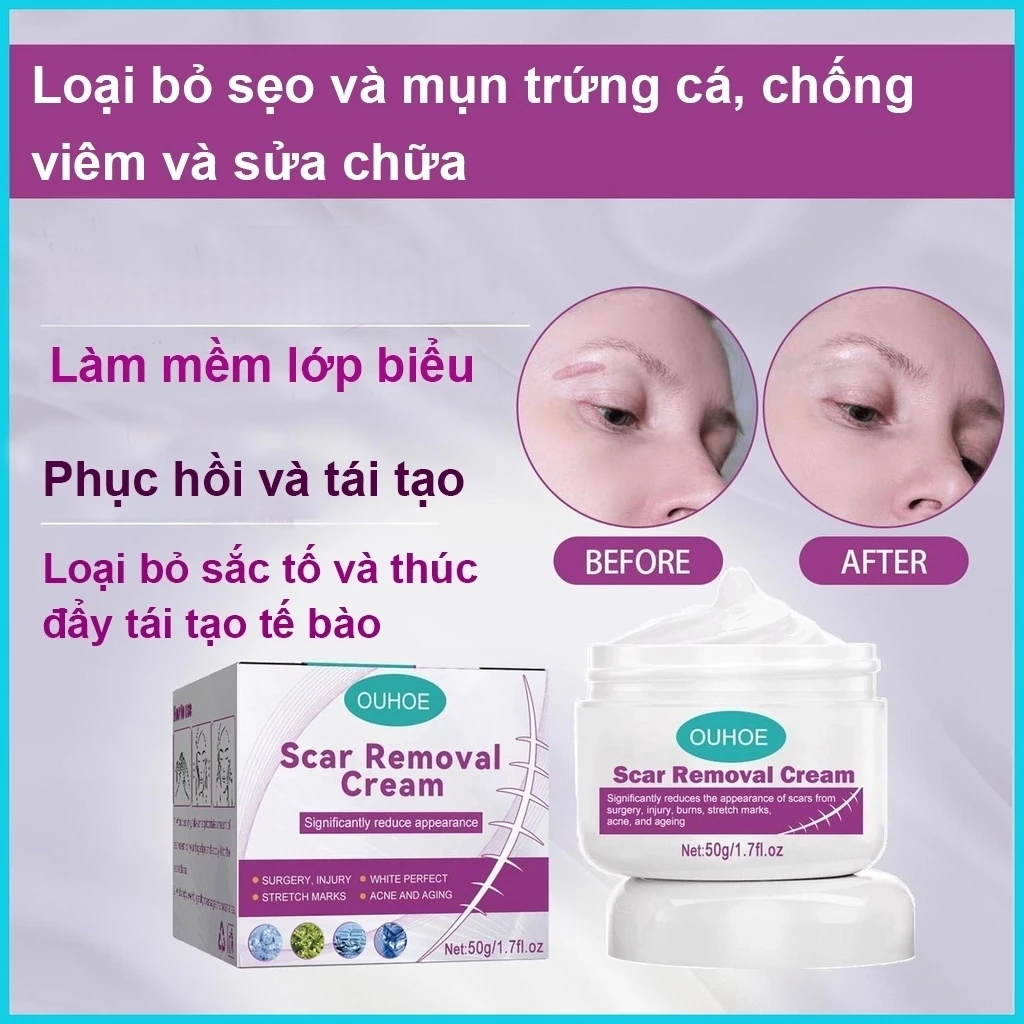 Kem LàM Mờ SẹO ThâM thâm sẹo do bị thương sẹo bỏng 16 seo7 1