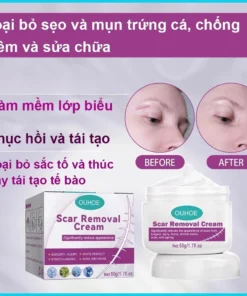 Kem LàM Mờ SẹO ThâM thâm sẹo do bị thương sẹo bỏng