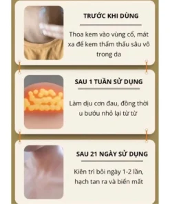 Kem Tan Hạch Bạch Huyết Nhật Bản - Hỗ Trợ Teo Hạch, Giảm Bướu Cổ - Tăng Cường Lưu Thông Mạch Máu 14 tanhach5