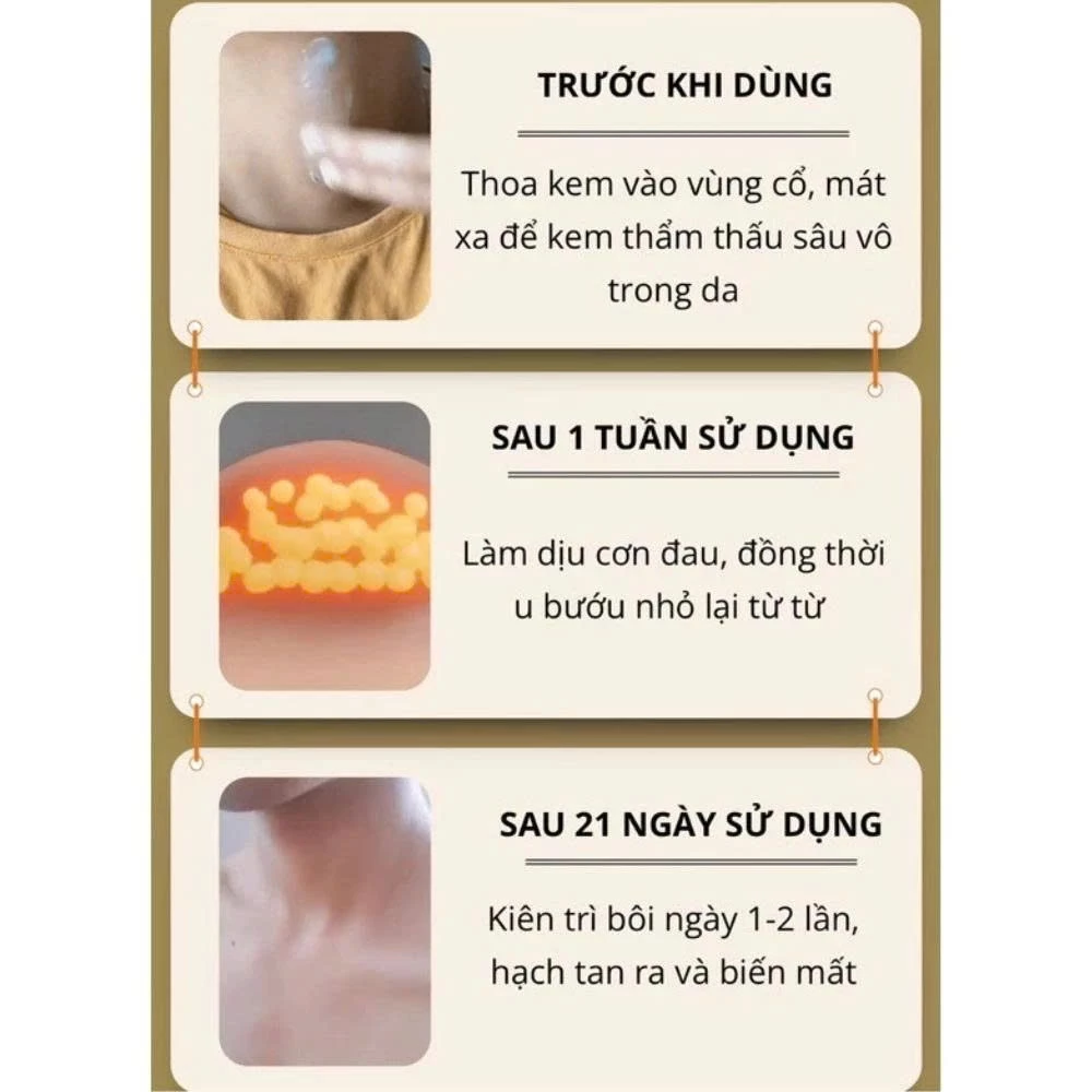 Kem Bôi Tan Hạch Bạch Huyết Cổ Truyền Nhật Bản , Tan Biến U Hạch, Giảm Đau Sưng Hạch Nhập Khẩu Chính Hãng 21 tanhach5