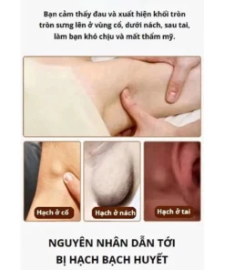 Kem Tan Hạch Bạch Huyết Nhật Bản - Hỗ Trợ Teo Hạch, Giảm Bướu Cổ - Tăng Cường Lưu Thông Mạch Máu 15 tanhach6