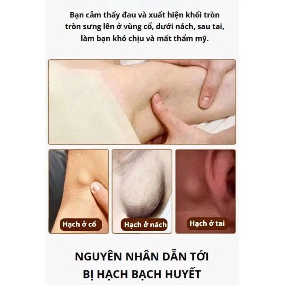 Kem Bôi Tan Hạch Bạch Huyết Cổ Truyền Nhật Bản , Tan Biến U Hạch, Giảm Đau Sưng Hạch Nhập Khẩu Chính Hãng 20 tanhach6