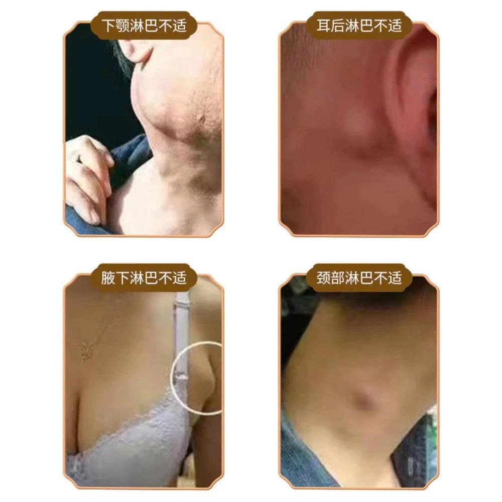 Kem Bôi Tan Hạch Bạch Huyết Cổ Truyền Nhật Bản , Tan Biến U Hạch, Giảm Đau Sưng Hạch Nhập Khẩu Chính Hãng 19 tanhach8