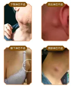 Kem Tan Hạch Cổ Truyền Nhật Bản, Teo U Hạch, Kem Mỡ Tiêu Tan Hạch Bạch Huyết 30g 17 tanhcha8