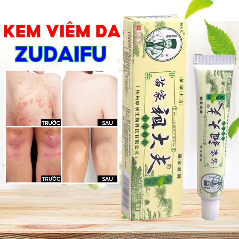 Kem Bôi Nấm Ngứa ZUDAIFU Hỗ Trợ Dứt Điểm Hắc Lào, Ghẻ Nước, Nấm Da Đầu, Vảy Nến Cực Kì Hiệu Quả 20 viemda1